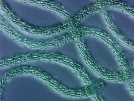 cyanobacteria